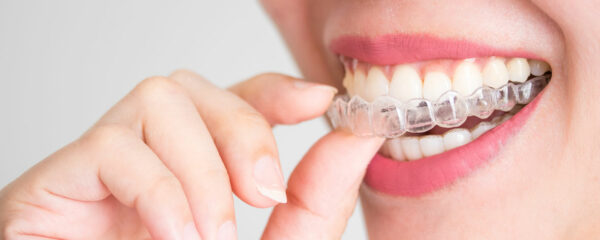 Invisalign