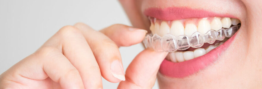 Invisalign